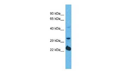 Western Blot: OR5D14 Antibody [NBP3-09801] - Western blot analysis of OR5D14 in 293T Whole cell lysates. Antibody dilution at 1.0ug/ml