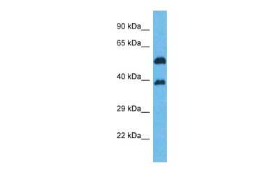Western Blot: OR5K2 Antibody [NBP3-09805] - Western blot analysis of OR5K2 in HepG2 Whole Cell lysates. Antibody dilution at 1.0ug/ml