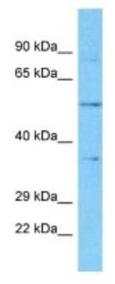 Western Blot: OR5K4 Antibody [NBP3-09807] - Western blot analysis of OR5K4 in NCI-H226 Whole Cell lysates. Antibody dilution at 1.0ug/ml