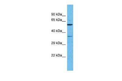 Western Blot: OR5L1 Antibody [NBP2-83330] - Host: Rabbit. Target Name: OR5C1. Sample Type: Hela Whole cell lysates. Antibody Dilution: 1.0ug/ml