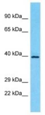 Western Blot: OR5M10 Antibody [NBP3-09817] - Western blot analysis of OR5M10 in Jurkat Whole Cell lysates. Antibody dilution at 1.0ug/ml