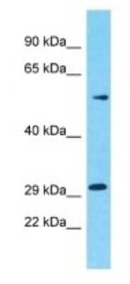 Western Blot: OR5M10 Antibody [NBP3-09819] - Western blot analysis of OR5M10 in HT1080 Whole Cell lysates. Antibody dilution at 1.0ug/ml