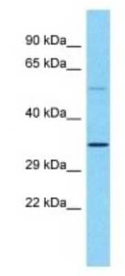 Western Blot: OR5M9 Antibody [NBP3-09818] - Western blot analysis of OR5M9 in OVCAR-3 Whole Cell lysates. Antibody dilution at 1.0ug/ml
