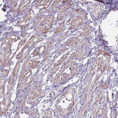 Immunohistochemistry-Paraffin OR5P3 Antibody