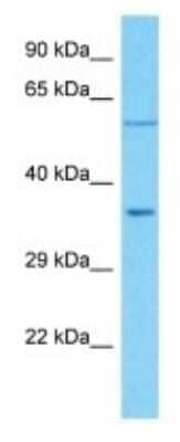 Western Blot: OR5R1 Antibody [NBP3-09821] - Western blot analysis of OR5R1 in Hela Whole Cell lysates. Antibody dilution at 1.0ug/ml