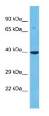 Western Blot: OR6B3 Antibody [NBP3-09822] - Western blot analysis of OR6B3 in Jurkat Whole Cell lysates. Antibody dilution at 1.0ug/ml