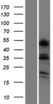 Western Blot: OR6C4 Overexpression Lysate (Adult Normal) [NBP2-08840] Left-Empty vector transfected control cell lysate (HEK293 cell lysate); Right -Over-expression Lysate for OR6C4.