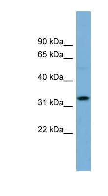 Western Blot: OR6C68 Antibody [NBP1-59859] - OVCAR-3 cell lysate, concentration 0.2-1 ug/ml.