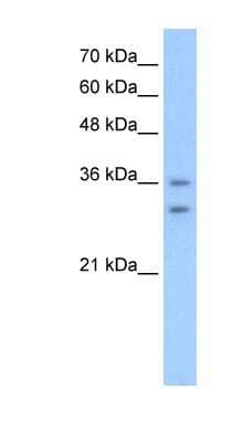 Western Blot: OR6C70 Antibody [NBP1-59363] - HepG2 cell lysate, concentration 2.5 ug/ml.