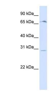 Western Blot: OR6C75 Antibody [NBP1-59362] - Human Placenta lysate, concentration 0.2-1 ug/ml.