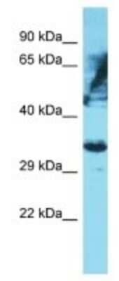 Western Blot OR6K2 Antibody - BSA Free