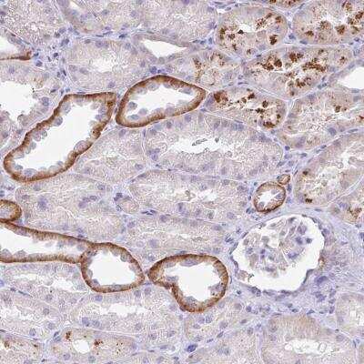 Immunohistochemistry-Paraffin OR6N2 Antibody - BSA Free