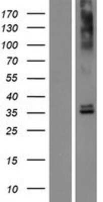 Western Blot OR6N2 Overexpression Lysate