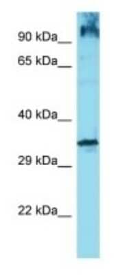 Western Blot: OR6Q1 Antibody [NBP3-09832] - Western blot analysis of OR6Q1 in Jurkat Whole Cell lysates. Antibody dilution at 1.0ug/ml