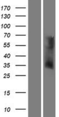 Western Blot OR6V1 Overexpression Lysate