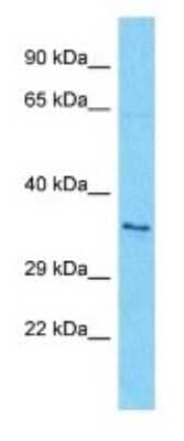 Western Blot: OR7A17 Antibody [NBP3-09812] - Western blot analysis of OR7A17 in HT1080 Whole Cell lysates. Antibody dilution at 1.0ug/ml