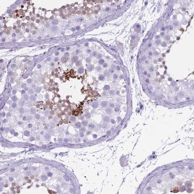 Immunohistochemistry-Paraffin OR7C1 Antibody