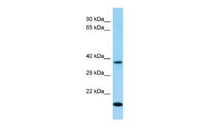 Western Blot: OR7D4 Antibody [NBP2-84204] - Host: Rabbit. Target Name: OR7D4. Sample Type: 293T Whole Cell lysates. Antibody Dilution: 1.0ug/ml