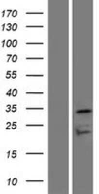 Western Blot: OR7D4 Overexpression Lysate (Adult Normal) [NBP2-08916] Left-Empty vector transfected control cell lysate (HEK293 cell lysate); Right -Over-expression Lysate for OR7D4.
