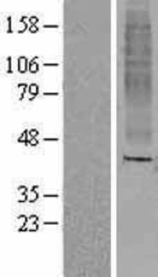 Western Blot: OR8A1 Overexpression Lysate (Adult Normal) [NBL1-13969] Left-Empty vector transfected control cell lysate (HEK293 cell lysate); Right -Over-expression Lysate for OR8A1.