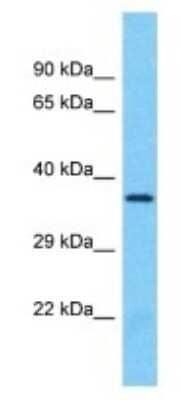 Western Blot: OR8B3 Antibody [NBP3-09815] - Western blot analysis of OR8B3 in U937 Whole Cell lysates. Antibody dilution at 1.0ug/ml