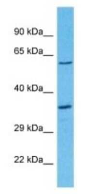 Western Blot OR8D2 Antibody