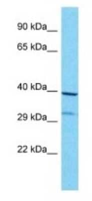 Western Blot: OR8G1 Antibody [NBP3-09825] - Western blot analysis of OR8G1 in MCF7 Whole Cell lysates. Antibody dilution at 1.0ug/ml