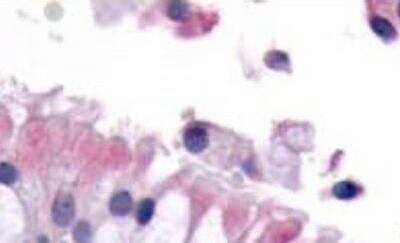 Immunohistochemistry-Paraffin: OR8G2 Antibody [NLS4354] - Analysis of anti-OR6K3 antibody with nasal mucosa, respiratory epithelium.