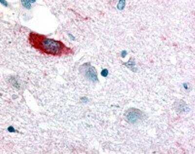 Immunohistochemistry-Paraffin: OR8G2 Antibody [NLS4354] - Analysis of anti-OR6K3 antibody with brain, neuron at 19 ug/ml.
