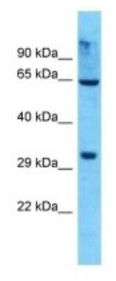 Western Blot: OR8K5 Antibody [NBP3-09831] - Western blot analysis of OR8K5 in 293T Whole Cell lysates. Antibody dilution at 1.0ug/ml