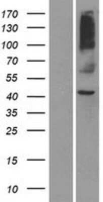 Western Blot OR8S1 Overexpression Lysate