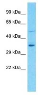 Western Blot: OR8U9 Antibody [NBP3-09833] - Western blot analysis of OR8U9 in Hela Whole Cell lysates. Antibody dilution at 1.0ug/ml