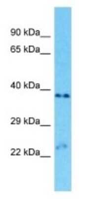 Western Blot: OR9A2 Antibody [NBP3-09836] - Western blot analysis of OR9A2 in ACHN Whole Cell lysates. Antibody dilution at 1.0ug/ml