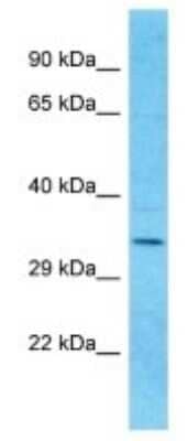 Western Blot: OR9I1 Antibody [NBP3-09838] - Western blot analysis of OR9I1 in Fetal Kidney lysates. Antibody dilution at 1.0ug/ml