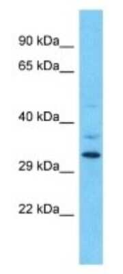Western Blot: OR9Q1 Antibody [NBP3-09840] - Western blot analysis of OR9Q1 in HT1080 Whole Cell lysates. Antibody dilution at 1.0ug/ml