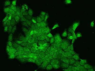 Immunocytochemistry/Immunofluorescence: ORAI3 Antibody [NBP2-98004] - Immunofluorescence staining of ORAI3 in A431 cells. Cells were fixed with 4% PFA, permeabilzed with 0.1% Triton X-100 in PBS, blocked with 10% serum, and incubated with rabbit anti-Human ORAI3 polyclonal antibody (dilution ratio 1:200) at 4C overnight. Then cells were stained with the Alexa Fluor(R)488-conjugated Goat Anti-rabbit IgG secondary antibody (green). Positive staining was localized to Nucleus and Cytoplasm.