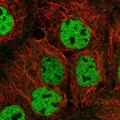 Immunocytochemistry/Immunofluorescence: ORAOV1 Antibody [NBP2-57312] - Staining of human cell line A-431 shows localization to nucleoplasm.
