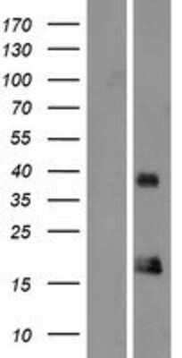 Western Blot: ORAOV1 Overexpression Lysate (Adult Normal) [NBP2-05251] Left-Empty vector transfected control cell lysate (HEK293 cell lysate); Right -Over-expression Lysate for ORAOV1.