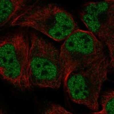 Immunocytochemistry/Immunofluorescence: ORC1 Antibody [NBP3-17790] - Staining of human cell line U-2 OS shows localization to nucleoplasm.