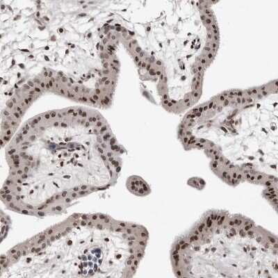 Immunohistochemistry-Paraffin: ORC1 Antibody [NBP1-83184] - Staining of human placenta shows strong nuclear positivity in trophoblastic cells.