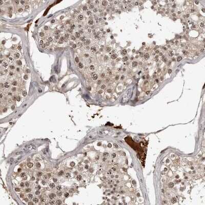 Immunohistochemistry-Paraffin: ORC1 Antibody [NBP1-83184] - Staining of human testis shows moderate nuclear positivity in cells in seminiferous ducts.