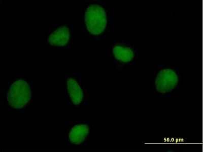 Immunocytochemistry/Immunofluorescence: ORC3L Antibody [H00023595-B01P] - Analysis of purified antibody to ORC3L on HeLa cell. (antibody concentration 10 ug/ml)