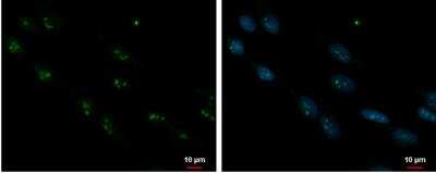Immunocytochemistry/Immunofluorescence: ORC3L Antibody [NBP2-19632] - SK-N-SH cells were fixed in 4% paraformaldehyde at RT for 15 min. Green: ORC3L protein stained by ORC3L antibody [N1N3]  diluted at 1:1000. Blue: Hoechst 33342 staining.