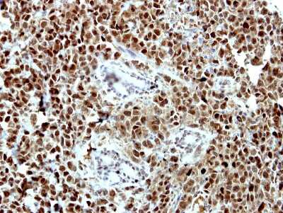 Immunohistochemistry-Paraffin: ORC3L Antibody [NBP2-19632] - Immunohistochemical analysis of paraffin-embedded HBL435 xenograft, using antibody at 1:100 dilution.
