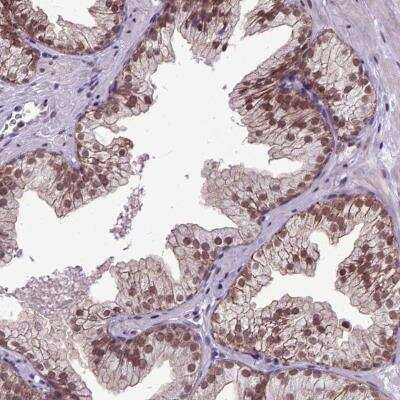 Immunohistochemistry: ORC5L Antibody [NBP1-82476] - Staining of human prostate shows moderate nuclear positivity in glandular cells.