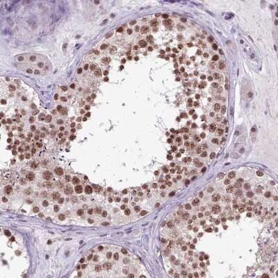 Immunohistochemistry-Paraffin ORC5L Antibody