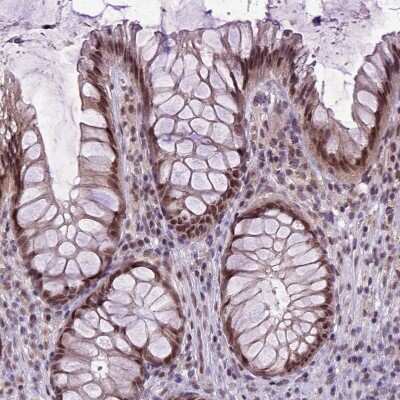 Immunohistochemistry-Paraffin: ORC5L Antibody [NBP1-82476] - Staining of human rectum shows moderate nuclear positivity in glandular cells.