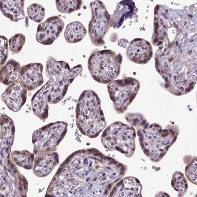 Immunohistochemistry-Paraffin: ORC5L Antibody [NBP1-82476] - Staining of human placenta shows moderate nuclear positivity in trophoblastic cells.