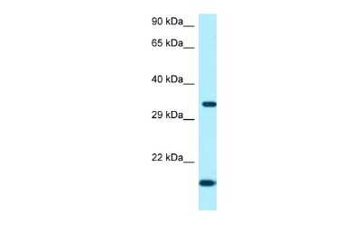 Western Blot: ORC5L Antibody [NBP2-83049] - WB Suggested Anti-ORC5 Antibody. Titration: 1.0 ug/ml. Positive Control: Fetal Heart