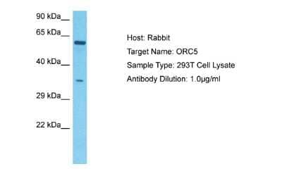 Western Blot: ORC5L Antibody [NBP2-83346] - Host: Rabbit. Target Name: ORC5. Sample Tissue: Human 293T Whole Cell lysates. Antibody Dilution: 1ug/ml